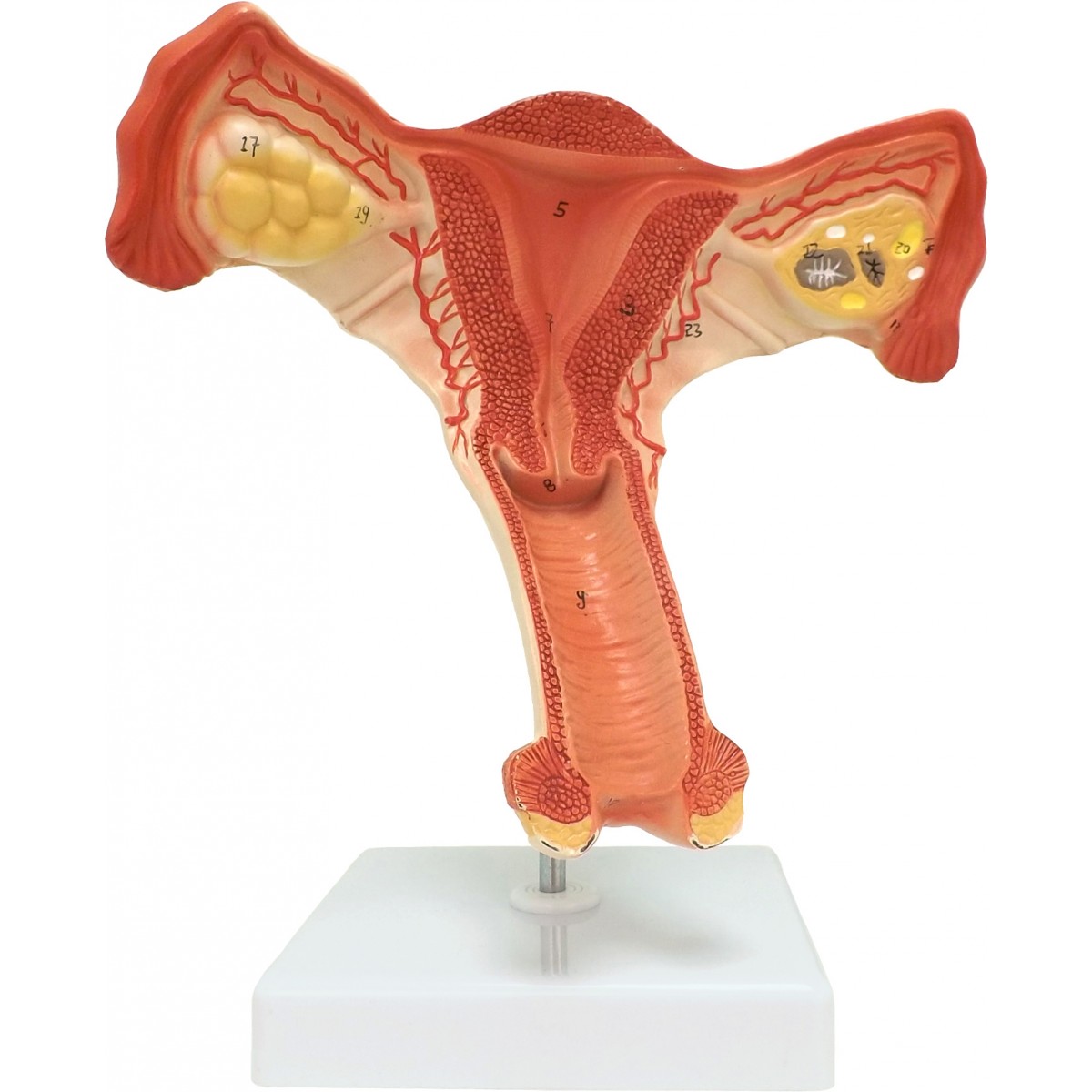 VAO464 Female Internal Organ - Reproductive System - Anatomical Models
