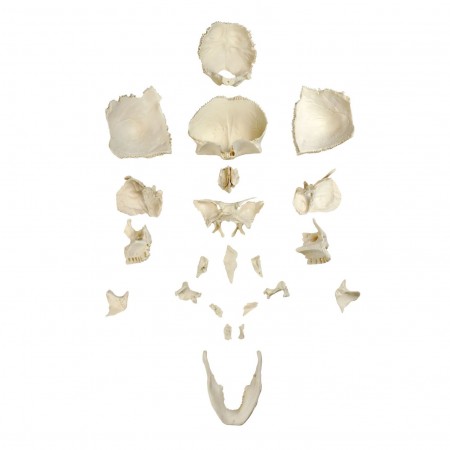 VAL251 Disarticulated Human Skull 